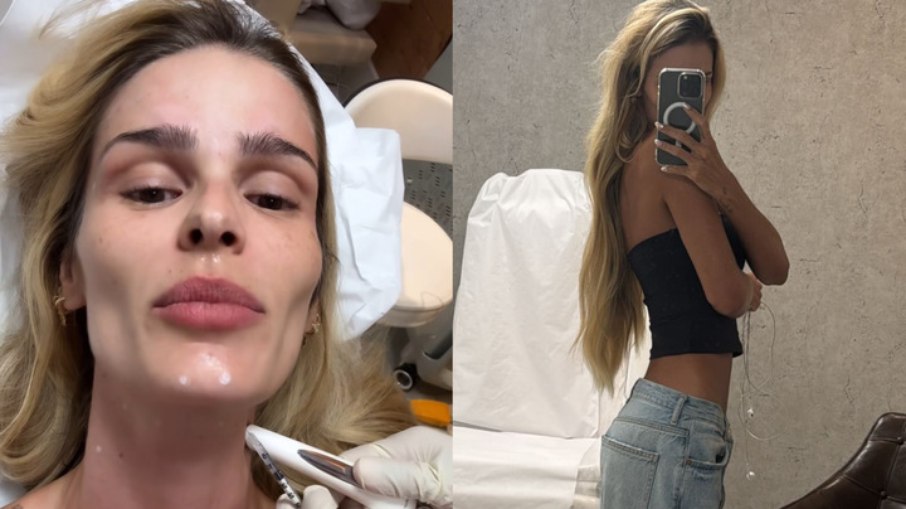 Yasmin Brunet põe botox e renova preenchimento no bumbum