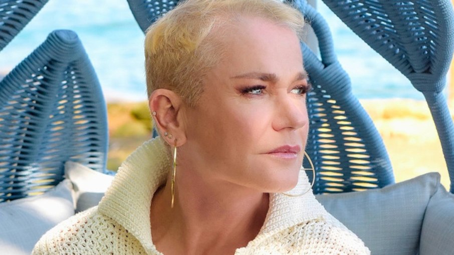 Xuxa revela implante capilar por falhas